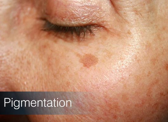 Homeo Skin Doctor In Guwahati