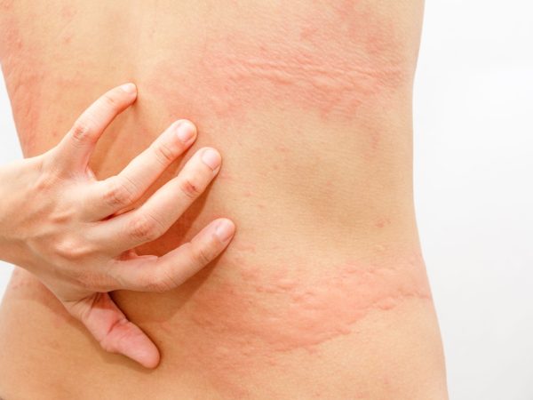Homeo Clinic In Guwahati Homeopathy Clinic In Guwahati
