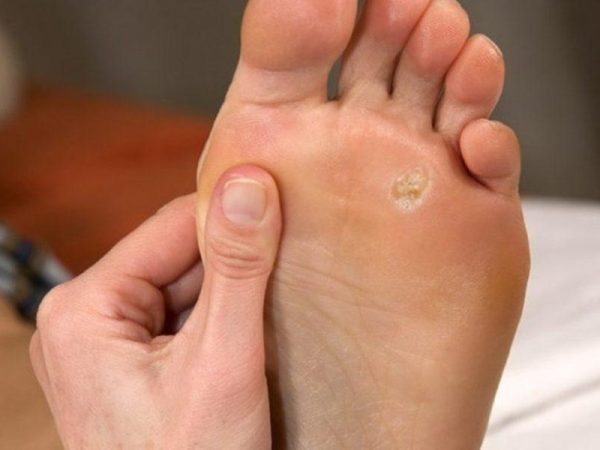 Homeo Skin Doctor In Guwahati