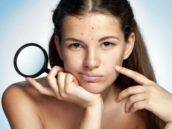 Homeo Skin Doctor In Guwahati